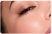 Beauty treatment result
